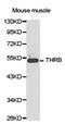 Thyroid Hormone Receptor Beta antibody, LS-C192915, Lifespan Biosciences, Western Blot image 