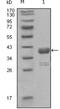 ABL Proto-Oncogene 1, Non-Receptor Tyrosine Kinase antibody, NBP2-37679, Novus Biologicals, Western Blot image 