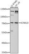 Potassium Two Pore Domain Channel Subfamily K Member 10 antibody, LS-C747084, Lifespan Biosciences, Western Blot image 