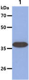 Arginase 2 antibody, GTX57645, GeneTex, Western Blot image 