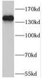 POM121 Transmembrane Nucleoporin antibody, FNab06636, FineTest, Western Blot image 