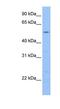 Myocardial Zonula Adherens Protein antibody, NBP1-55528, Novus Biologicals, Western Blot image 