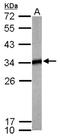 Tropomyosin 4 antibody, NBP2-15146, Novus Biologicals, Western Blot image 