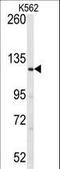 Large Tumor Suppressor Kinase 1 antibody, LS-C98952, Lifespan Biosciences, Western Blot image 