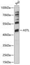 Astacin Like Metalloendopeptidase antibody, 15-819, ProSci, Western Blot image 