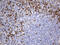 Optineurin antibody, M00952-1, Boster Biological Technology, Immunohistochemistry paraffin image 