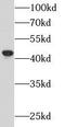 Apolipoprotein B MRNA Editing Enzyme Catalytic Subunit 3G antibody, FNab00495, FineTest, Western Blot image 
