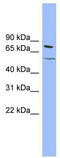 Potassium Voltage-Gated Channel Subfamily Q Member 4 antibody, TA338541, Origene, Western Blot image 
