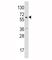 Cytochrome P450 Family 19 Subfamily A Member 1 antibody, F50523-0.4ML, NSJ Bioreagents, Western Blot image 