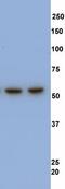 Coronin 1A antibody, ab56820, Abcam, Western Blot image 