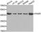 Pro-Apoptotic WT1 Regulator antibody, MBS127300, MyBioSource, Western Blot image 