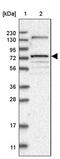 Transforming Acidic Coiled-Coil Containing Protein 1 antibody, PA5-55159, Invitrogen Antibodies, Western Blot image 