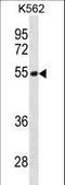 Testin LIM Domain Protein antibody, LS-C156206, Lifespan Biosciences, Western Blot image 