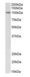 Ubiquitin Like With PHD And Ring Finger Domains 1 antibody, orb176720, Biorbyt, Western Blot image 