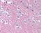 Neural Cell Adhesion Molecule 1 antibody, 49-121, ProSci, Immunohistochemistry paraffin image 