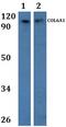 Collagen Type VI Alpha 1 Chain antibody, PA5-75857, Invitrogen Antibodies, Western Blot image 