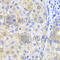 Ferritin Heavy Chain 1 antibody, A1144, ABclonal Technology, Immunohistochemistry paraffin image 