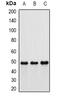 Intraflagellar Transport 57 antibody, abx141382, Abbexa, Western Blot image 