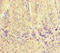Voltage Dependent Anion Channel 2 antibody, LS-C679976, Lifespan Biosciences, Immunohistochemistry paraffin image 