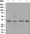 Casein Kinase 1 Alpha 1 antibody, ab108296, Abcam, Western Blot image 