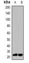 Ras Homolog, MTORC1 Binding antibody, orb382586, Biorbyt, Western Blot image 