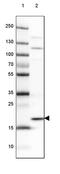 Centromere Protein M antibody, PA5-59969, Invitrogen Antibodies, Western Blot image 