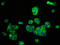 Potassium Voltage-Gated Channel Subfamily J Member 8 antibody, LS-C674944, Lifespan Biosciences, Immunofluorescence image 