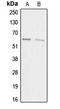 Acrosin-binding protein antibody, LS-C353584, Lifespan Biosciences, Western Blot image 