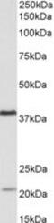 Kelch Domain Containing 8B antibody, MBS422620, MyBioSource, Western Blot image 