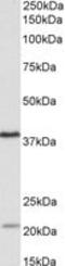 Kelch Domain Containing 8B antibody, MBS422620, MyBioSource, Western Blot image 