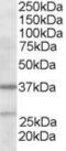 ARPC1B antibody, TA302795, Origene, Western Blot image 