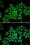 ATPase Sarcoplasmic/Endoplasmic Reticulum Ca2+ Transporting 2 antibody, LS-C331256, Lifespan Biosciences, Immunofluorescence image 