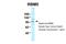 RNA Binding Motif Protein 5 antibody, 25-444, ProSci, Enzyme Linked Immunosorbent Assay image 