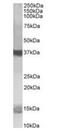 Prefoldin Subunit 1 antibody, orb18833, Biorbyt, Western Blot image 