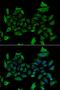 5'-Aminolevulinate Synthase 1 antibody, orb247474, Biorbyt, Immunofluorescence image 