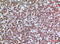 CD200 Molecule antibody, A01512-2, Boster Biological Technology, Immunohistochemistry paraffin image 