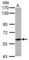 Potassium Voltage-Gated Channel Subfamily D Member 2 antibody, NBP2-19314, Novus Biologicals, Western Blot image 
