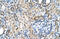 Solute Carrier Family 19 Member 1 antibody, ARP44167_T100, Aviva Systems Biology, Immunohistochemistry paraffin image 