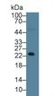 NPHS1 Adhesion Molecule, Nephrin antibody, LS-C722759, Lifespan Biosciences, Western Blot image 