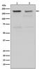 DNA Topoisomerase II Alpha antibody, M00953-1, Boster Biological Technology, Western Blot image 