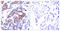 ETS Transcription Factor ELK1 antibody, LS-C198914, Lifespan Biosciences, Immunohistochemistry paraffin image 