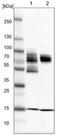 Zinc Finger And SCAN Domain Containing 2 antibody, NBP1-82169, Novus Biologicals, Western Blot image 
