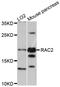 Rac Family Small GTPase 2 antibody, STJ110976, St John