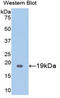 Thrombomodulin antibody, LS-C297801, Lifespan Biosciences, Western Blot image 