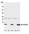 S100 Calcium Binding Protein A16 antibody, A305-655A-M, Bethyl Labs, Western Blot image 