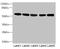 Fyn Related Src Family Tyrosine Kinase antibody, LS-C675775, Lifespan Biosciences, Western Blot image 