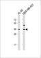 Olfactory Receptor Family 1 Subfamily J Member 4 antibody, 55-598, ProSci, Western Blot image 