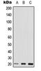 Ras Homolog Family Member Q antibody, orb215557, Biorbyt, Western Blot image 