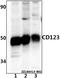 Interleukin 3 Receptor Subunit Alpha antibody, A04307S47, Boster Biological Technology, Western Blot image 