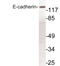 Cadherin 1 antibody, LS-C175998, Lifespan Biosciences, Western Blot image 